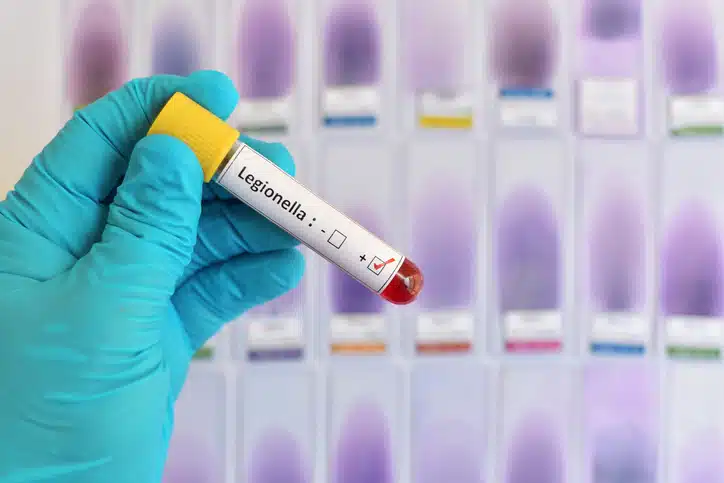 foto di una mano con guanto in lattice celeste che tiene in m,ano una provetta analisi per legionella